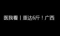 医我看丨重达6斤
！广西女子乳腺肿瘤2年疯长至篮球大，医生提醒	：这些情况务必重视