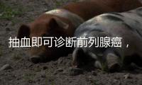 抽血即可诊断前列腺癌	，拜登为何不测？