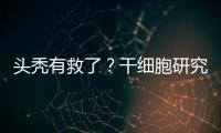 头秃有救了�？干细胞研究阐明压力如何影响毛发生长