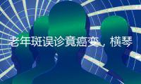 老年斑误诊竟癌变，横琴医院提醒
：医学美容需科学诊断与规范治疗